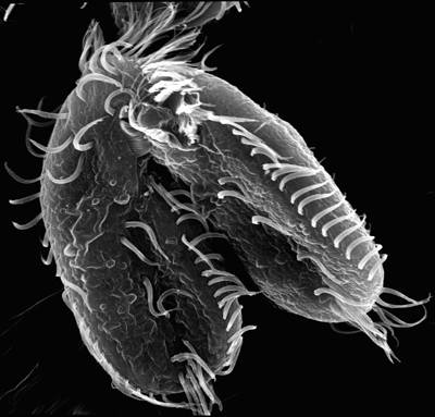 Oxytricha