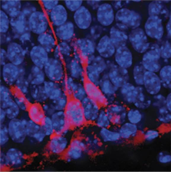 adult hippocampal neurons that are less than two weeks old